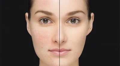 پرایمر صورت ژنوبایوتیک پوست چرب و مختلط Covering Pores حجم 30 میل